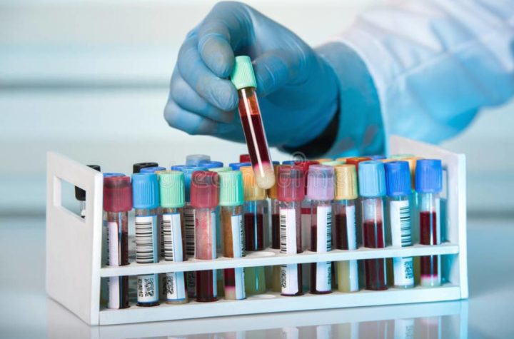 Laboratorio privado cobra 5,500 pesos por prueba de coronavirus en el país