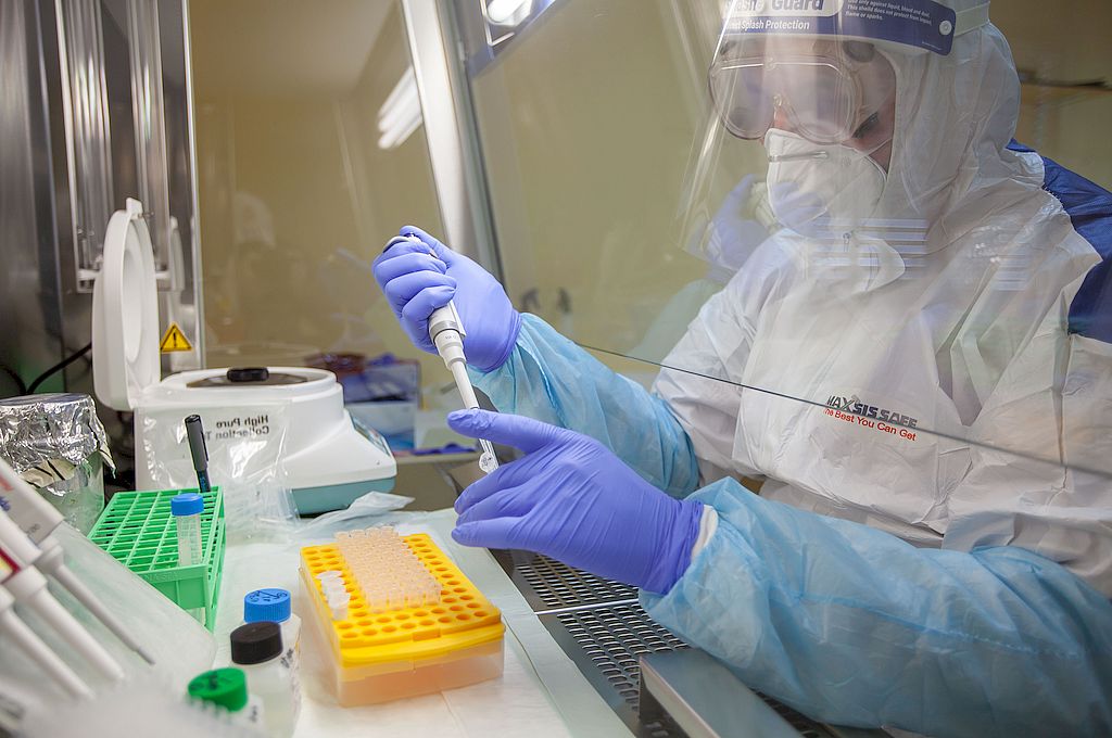 Un laboratorio francés desarrolla primer test serológico que mide grado de inmunidad al coronavirus