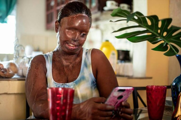 Víctimas del ácido del diablo reclamarán justicia frente al Congreso Nacional