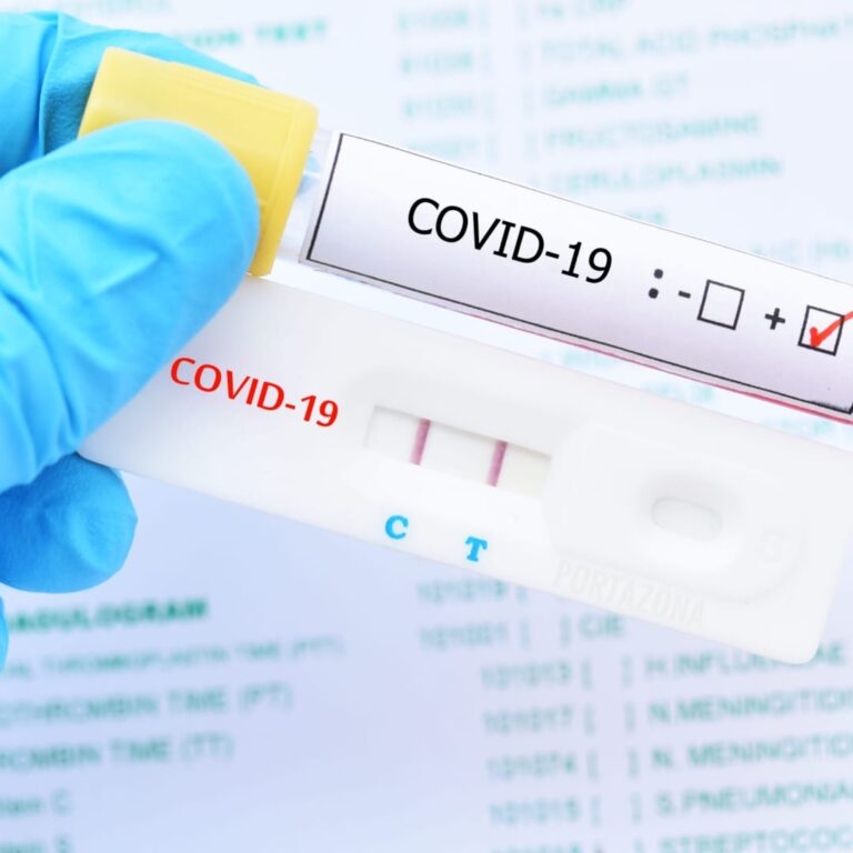 Salud Pública reporta cuatro nuevos fallecimientos y 876 nuevos casos de COVID-19