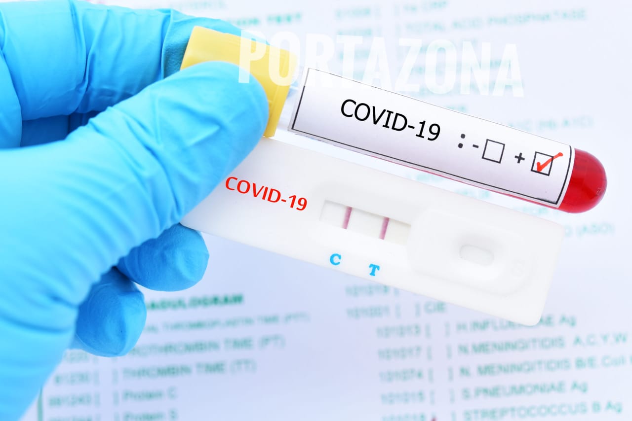 República Dominicana reporta 13 muertos por coronavirus y 878 nuevos contagios